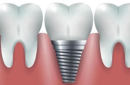 武漢德韓口腔：如何選擇好的種植牙機構呢？