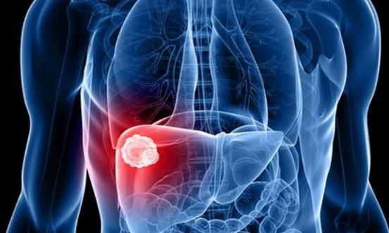 男性最需要去做的就是養肝 選對正確的具有護肝功效的食物