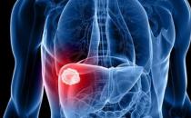 ?男性最需要去做的就是養肝 選對正確的具有護肝功效的食物