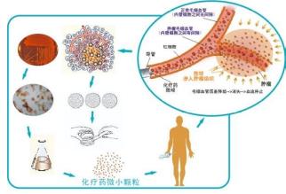 廣州復大腫瘤醫院牛立志教授：癌癥治療技術——血管介入療法