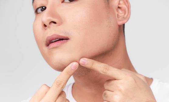 下巴長痘痘怎么辦 祛痘小竅門
