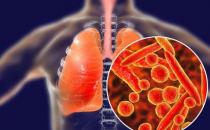 一文讀懂 | 預防新型冠狀病毒肺炎 感染源、傳染方式及癥狀表現