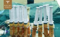 北京潤美玉之光張紅芳丨自體脂肪精度填充，在細節上提升效果