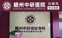 贛州白癜風醫院離火車站多遠 疫情期間白癜風患者怎么提高免疫力