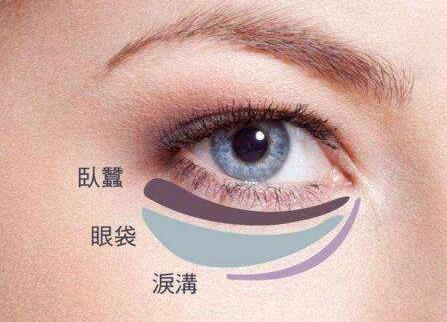 八大處整形楊欣幫你講解：眼袋祛除后過幾年還會復發嗎？