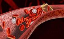 ?能軟化血管的12種食物 讓血管恢復正常