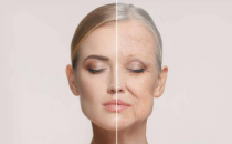 ?肌美人蔓越莓膠原蛋白肽，阻擊自然老化，恢復(fù)年輕體態(tài)