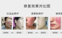 放心！有美薏升修復(fù)敏感肌紅血絲專家產(chǎn)品在，你每天都可以美美噠