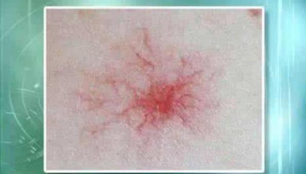 長期睡前玩手機的人，面部若有3癥狀，可能是肝在“吐槽”